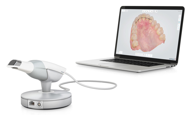 Intraoralscanner Digitale Abformung Lauterbach
